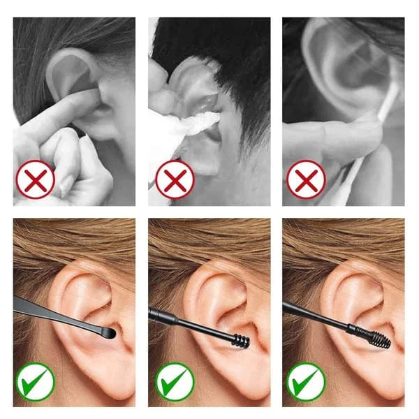 Kit Complet de Nettoyage des Oreilles